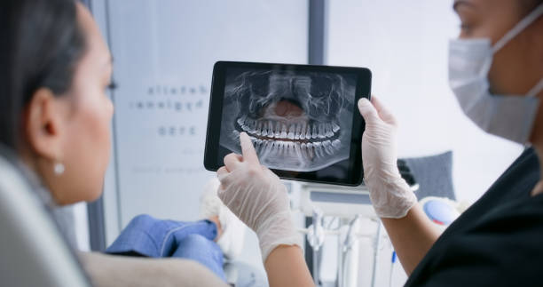 Licensed Dental Implants service in Oxford, GA - Smile Center Dentistry