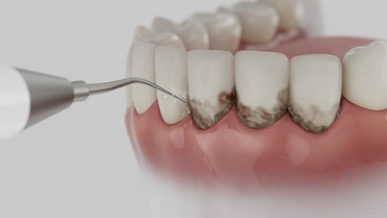 Reliable Dental Implants contractor in Oxford, GA by Smile Center Dentistry